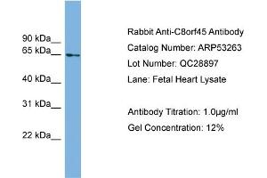 WB Suggested Anti-C8orf45  Antibody Titration: 0. (C8orf45 Antikörper  (Middle Region))