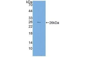 Detection of Recombinant FKBP7, Human using Polyclonal Antibody to FK506 Binding Protein 7 (FKBP7) (FKBP7 Antikörper  (AA 24-217))