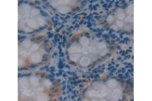 IHC-P analysis of Kidney tissue, with DAB staining. (HAUS7 Antikörper  (AA 4-319))