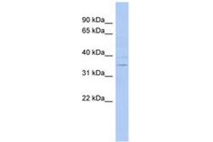 Image no. 1 for anti-Aspartate Dehydrogenase Domain Containing (ASPDH) (AA 71-120) antibody (ABIN6744015) (ASPDH Antikörper  (AA 71-120))