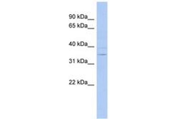 ASPDH anticorps  (AA 71-120)