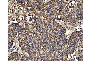 IHC analysis of HSD17B7 using anti-HSD17B7 antibody (ABIN7600174). (HSD17B7 Antikörper  (AA 16-336))