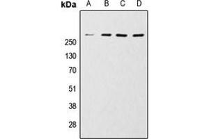 Western blot analysis of mTOR expression in HeLa (A), MCF7 (B), Jurkat (C), A431 (D) whole cell lysates. (MTOR Antikörper  (C-Term))
