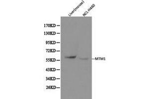 Western Blotting (WB) image for anti-Myotubularin 1 (MTM1) antibody (ABIN1873773) (MTM1 Antikörper)