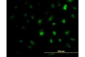 Image no. 1 for anti-Zic Family Member 4 (ZIC4) (AA 249-320) antibody (ABIN466252) (ZIC4 Antikörper  (AA 249-320))