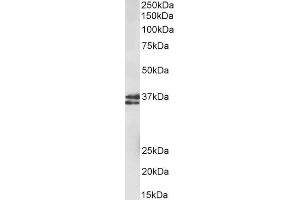 ABIN2613452 (1µg/ml) staining of fetal Mouse Brain lysate (35µg protein in RIPA buffer).