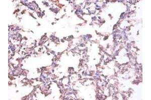 Immunohistochemistry of paraffin-embedded human lung tissue using ABIN7173786 at dilution of 1:100 (LTA Antikörper  (AA 39-281))