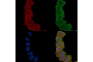 ABIN6265833 and ABIN6277102 staining Hela cells(30 min of UV treatment) by IF/ICC. (UAP1 Antikörper  (Internal Region))