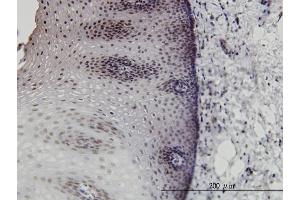 Immunoperoxidase of monoclonal antibody to DLX2 on formalin-fixed paraffin-embedded human esophagus. (DLX2 Antikörper  (AA 1-110))