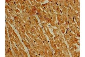 Immunohistochemistry (IHC) image for anti-Phosphoinositide 3-kinase Regulatory Subunit 4 (PIK3R4) (AA 1300-1358), (Regulatory Subunit 4) antibody (ABIN7163291)
