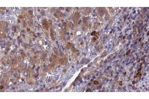 Immunohistochemistry (IHC) image for anti-Cell Adhesion Molecule 1 (CADM1) (Internal Region) antibody (ABIN6260400)