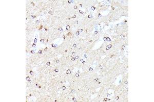 Immunohistochemistry of paraffin-embedded mouse brain using CCDC6 antibody (ABIN7266442) at dilution of 1:100 (40x lens). (CCDC6 Antikörper  (AA 55-222))