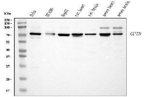 Western blot analysis of Optineurin using anti-Optineurin antibody (ABIN3042498).