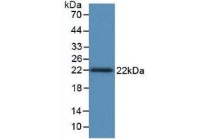 Detection of Recombinant TNFb, Human using Monoclonal Antibody to Tumor Necrosis Factor Beta (TNFb) (LTA Antikörper  (AA 36-205))