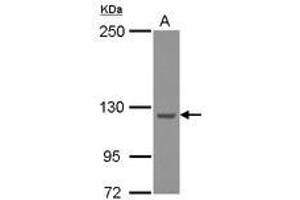 Image no. 2 for anti-WASH Complex Subunit 5 (WASHC5) (C-Term) antibody (ABIN1491792) (Strumpellin Antikörper  (C-Term))