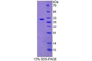SDS-PAGE analysis of Human MPG Protein. (MPG Protein)