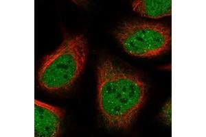 Immunofluorescent staining of human cell line U-2 OS with ANKRD12 polyclonal antibody  at 1-4 ug/mL dilution shows positivity in nucleus but not nucleoli and cytoplasm.