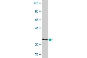 Western Blot detection against Immunogen (36. (CRYBB3 Antikörper  (AA 112-211))