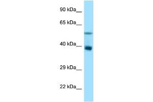 WB Suggested Anti-Trim7 Antibody Titration: 1. (TRIM7 Antikörper  (N-Term))