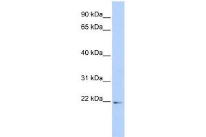 WB Suggested Anti-PDLIM5 Antibody Titration:  0. (PDLIM5 Antikörper  (Middle Region))