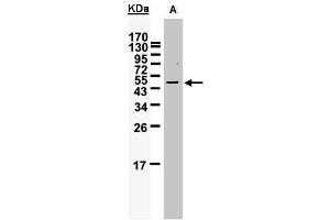 WB Image Sample (25 ug of whole cell lysate) A: Hone1 (WTAP Antikörper  (Center))