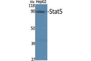 Western Blot (WB) analysis of specific cells using Stat5 Polyclonal Antibody.