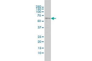 SRCRB4D monoclonal antibody (M01), clone 3D9 Western Blot analysis of SRCRB4D expression in C32 . (SRCRB4D Antikörper  (AA 1-190))