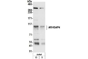 anti-rho GTPase Activating Protein 4 (ARHGAP4) (AA 350-400) antibody