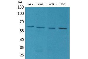 Western Blot (WB) analysis of HeLa, K562, MCF7, PC-3 cells using p63 Polyclonal Antibody. (TCP1 alpha/CCTA Antikörper  (N-Term))