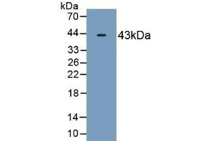 Detection of Recombinant OAS2, Human using Monoclonal Antibody to 2',5'-Oligoadenylate Synthetase 2 (OAS2) (OAS2 Antikörper  (AA 11-346))