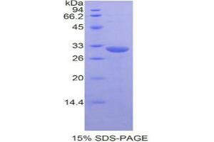 SDS-PAGE analysis of Mouse MAPK8 Protein. (JNK Protein)