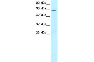 WB Suggested Anti-FOXG1A Antibody Titration:  5. (FOXG1 Antikörper  (N-Term))