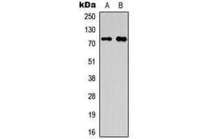 Western blot analysis of OLFML2A expression in HepG2 (A), A549 (B) whole cell lysates. (OLFML2A Antikörper  (Center))
