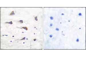 Immunohistochemical analysis of paraffin-embedded human brain tissue using GluR6 antibody. (Metabotropic Glutamate Receptor 6 Antikörper)
