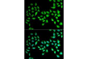 Immunofluorescence analysis of U2OS cells using UCN2 antibody (ABIN5973879). (Urocortin 2 Antikörper)