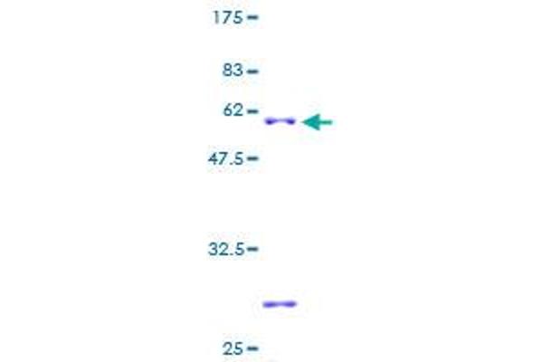 SLC25A17 Protein (AA 1-307) (GST tag)