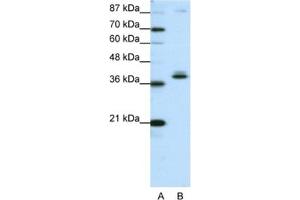 Western Blotting (WB) image for anti-Zinc Finger Protein 25 (ZNF25) antibody (ABIN2461975) (ZNF25 Antikörper)