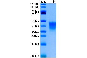 Biotinylated Human CD7 on Tris-Bis PAGE under reduced condition. (CD7 Protein (CD7) (AA 26-180) (His-Avi Tag,Biotin))