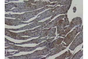 IHC analysis of NRF1 using anti-NRF1 antibody (ABIN6719347). (NRF1 Antikörper  (AA 246-503))