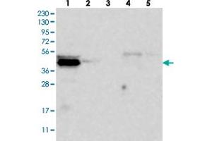 Western blot analysis of Lane 1: RT-4, Lane 2: U-251 MG, Lane 3: Human Plasma, Lane 4: Liver, Lane 5: Tonsil with C9orf41 polyclonal antibody  at 1:250-1:500 dilution. (C9orf41 Antikörper)