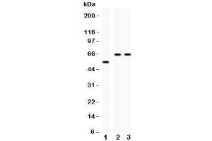 Western blot testing of CYP2E1 antibody and Lane 1:  rat liver;  2: human HeLa;  3: (h) Jurkat;  Observed size: 56-65KD (CYP2E1 Antikörper  (AA 1-310))