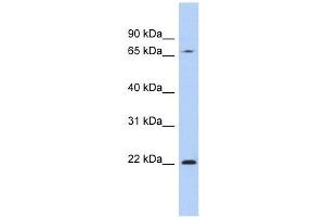 RPS7 antibody used at 1 ug/ml to detect target protein. (RPS7 Antikörper  (N-Term))