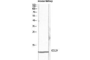 Western Blot (WB) analysis of Mouse Kidney lysis using CCL27 antibody. (CCL27 Antikörper)