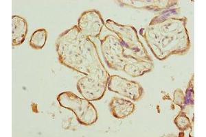 Immunohistochemistry of paraffin-embedded human placenta tissue using ABIN7146547 at dilution of 1:100 (Calpain 6 Antikörper  (AA 195-494))