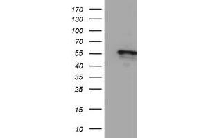 Western Blotting (WB) image for anti-Cytochrome P450, Family 2, Subfamily A, Polypeptide 6 (CYP2A6) antibody (ABIN1497723)
