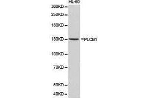 Western Blotting (WB) image for anti-phospholipase C, beta 1 (phosphoinositide-Specific) (PLCB1) antibody (ABIN1874160) (Phospholipase C beta 1 Antikörper)