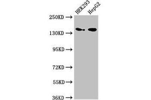 Western Blot Positive WB detected in: HEK293 whole cell lysate, HepG2 whole cell lysate All lanes: MAN2A1 antibody at 3. (alpha-Mannosidase II Antikörper  (AA 31-181))