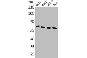 Western Blot analysis of HeLa K562 MCF7 PC-3 cells using p63 Polyclonal Antibody (p63 Antikörper  (N-Term))