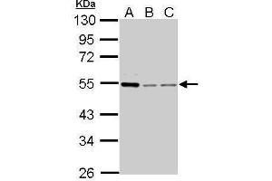 Western Blotting (WB) image for anti-Cyclin A2 (CCNA2) antibody (ABIN2855543)