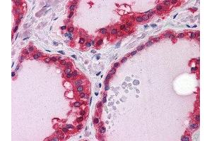 Immunohistochemistry (IHC) image for anti-Suppression of Tumorigenicity 13 (ST13) antibody (ABIN1845122) (HSC70 Interacting Protein HIP Antikörper)